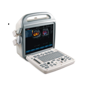 Ultrasonido color doppler